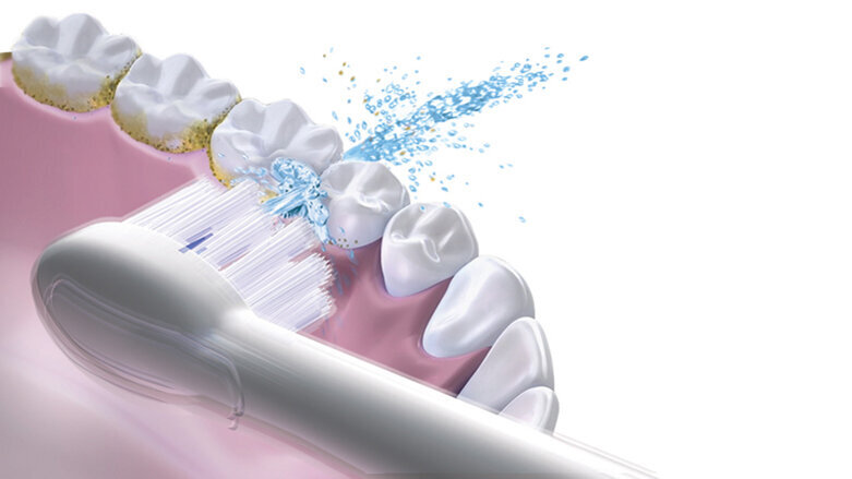 Waterpik Sonic-Fusion Professional