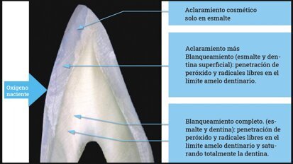 Estética y blanqueamiento dental en la era digital  (Capítulo 9)