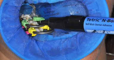 Las restauraciones en bloque, un cambio de paradigma