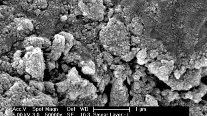 L’effet photoacoustique en endodontie