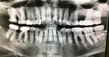 Diagnostic tips for bone lesions with DTX Studio Clinic