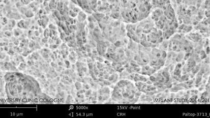 Clean dental implants essential for clinical success