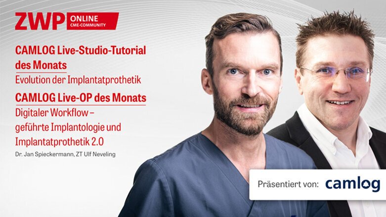 2 CME-Punkte: CAMLOG Live-Studio-Tutorial & Live-OP im Archiv