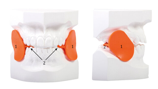 La recidiva in ortodonzia