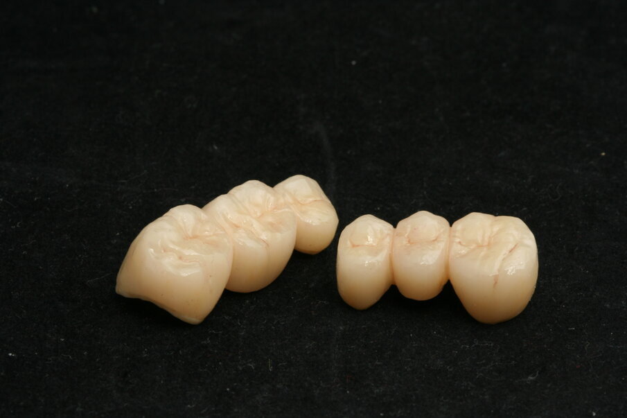 Fig. 23: Completed CAD-on bridge 