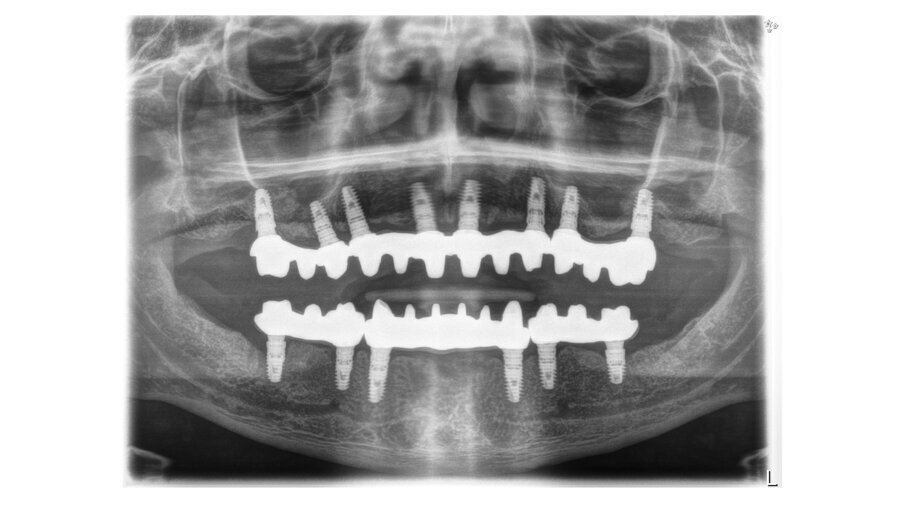 Fig. 9: Panoramic view of the finished case.