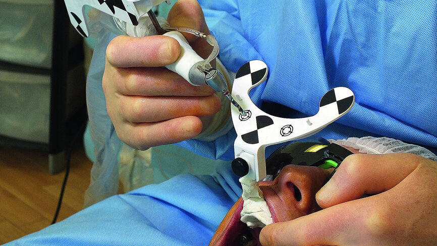 Fig. 9: Calibration of 3.5 mm drill tip.