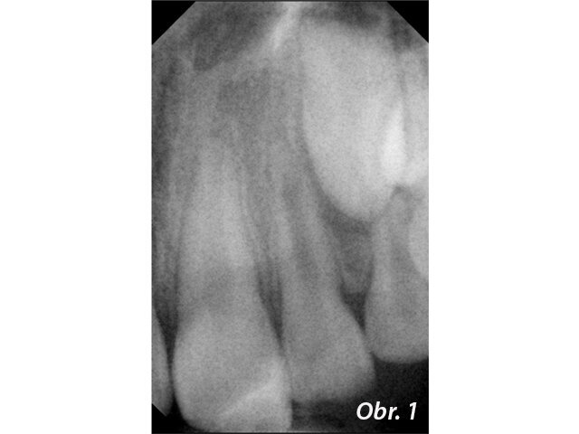 Obr. 1: květen 2008