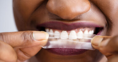 Non-peroxide whitening strips offer bright competition