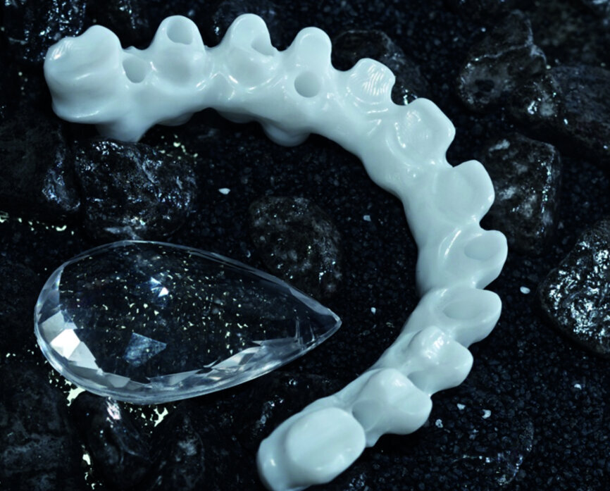 Figure 4 : Détail d’une armature en zircone qui sera complétée par de la céramique classique, à noter qu’il faudra disposer d’une DVO suffisante afin de garder une section de zircone compatible avec la solidité du bridge