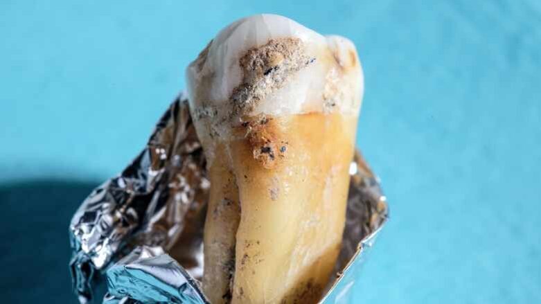 Die Entwicklungsgeschichte unserer Mundflora