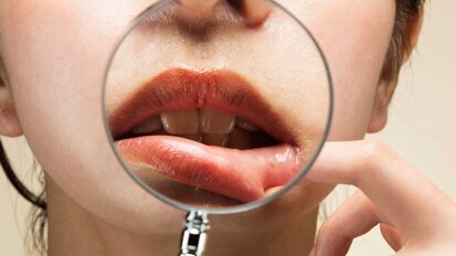 Update S2k-Leitlinie: Diagnostik und Therapieoptionen