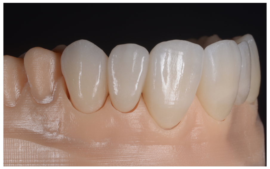 Fig. 26a_Finalizzazione del lavoro sul modello.