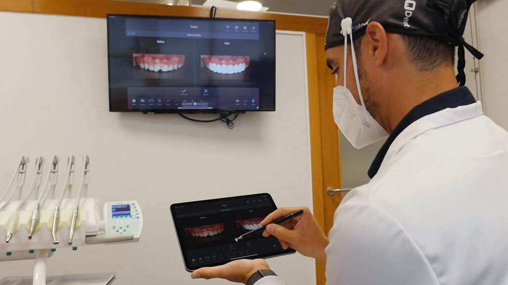 Dentool app: Streamlined efficiency and enhanced patient communication