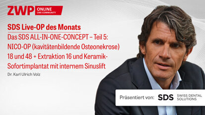 1 CME-Punkt: Live-OP „Das SDS ALL-IN-ONE-CONCEPT – Teil 5“ im Archiv 1 CME-Punkt: Live-OP „Das SDS ALL-IN-ONE-CONCEPT – Teil 5“ im Archiv