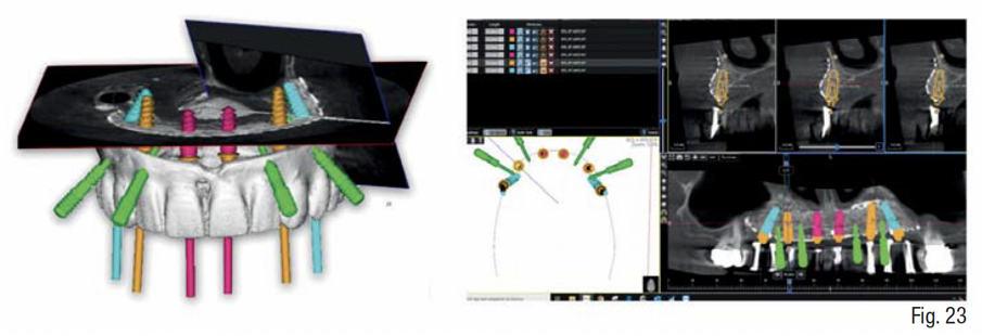 Fig. 23