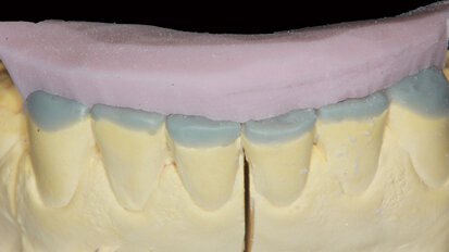 Minimální invazivita – maximální efektivita: Paradigma současné dekády záchovné stomatologie