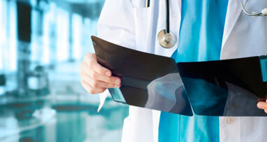 La malattia parodontale aumenta il rischio di cancro al seno nelle donne in postmenopausa