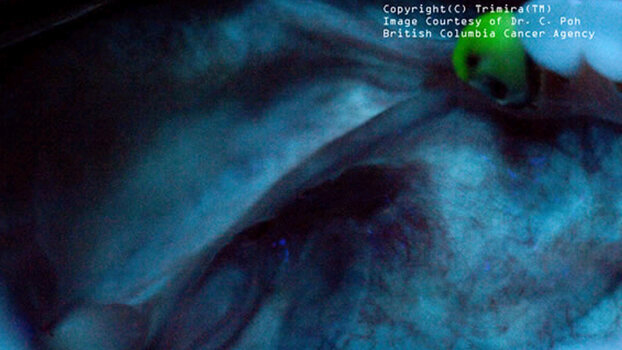 Trimira offers oral cancer images online