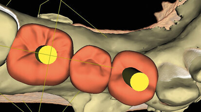 Reliable planning for an optimal workflow. User case abstract