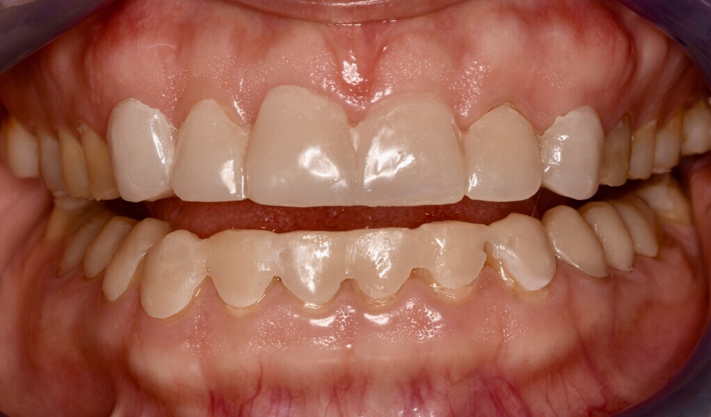 Fig. 5: 3D-printed mock-up.