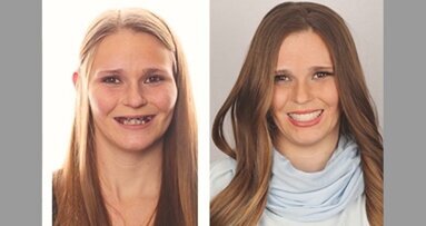 Caso Clínico: Una sonrisa para Andrea