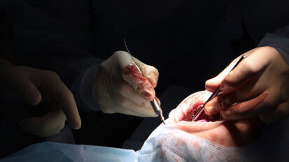 Clinical success in guided full-arch rehabilitation using Smilecloud