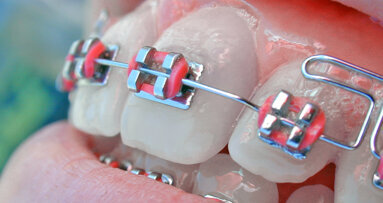 AAO reminds families about changes in FSA rules