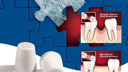 ΚΩΝΟΙ ΚΟΛΛΑΓΟΝΟΥ PARASORB©