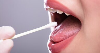 Une étude suggère que les tests de salive pourraient révolutionner le suivi de la parodontite