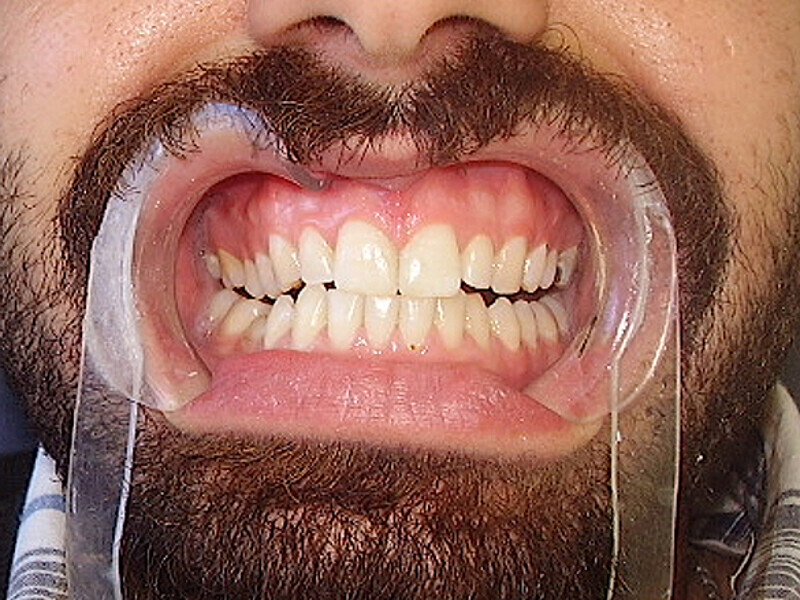 Figura 5. Situación final.