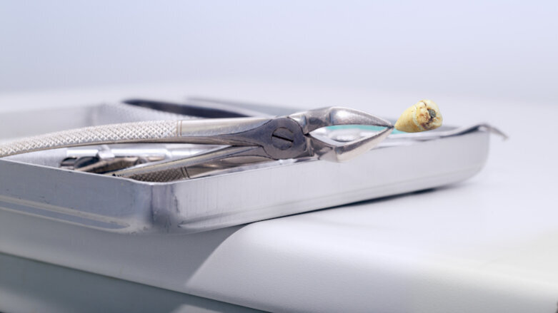 Dental practices urged to install amalgam separator