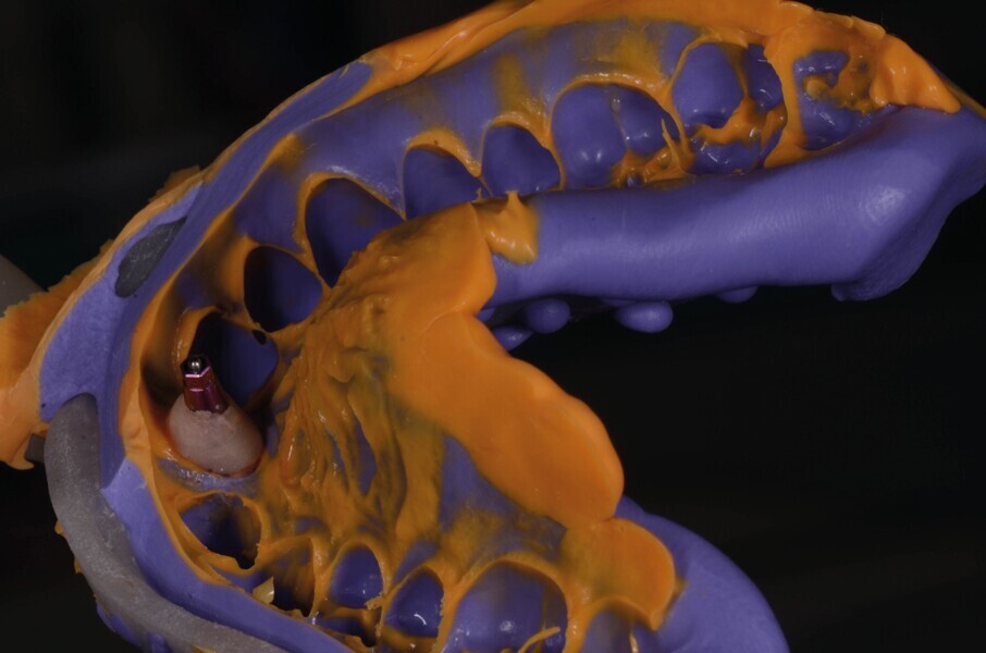 Fig. 19b : empreinte avec transfert en place.