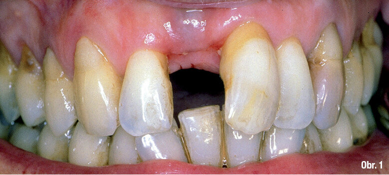 Počáteční situace