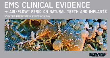 Air-Flow Perio di EMS supera con successo gli studi clinici