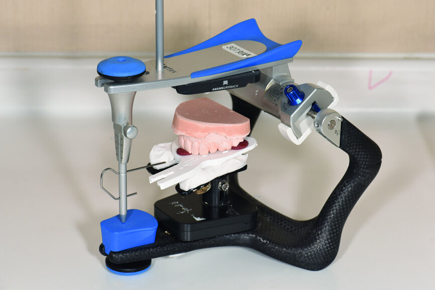 Fig. 25: Mounting of the provisional restoration.
