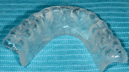 Attualità clinica  della semeiotica occluso-posturale: protocollo diagnostico e caso clinico