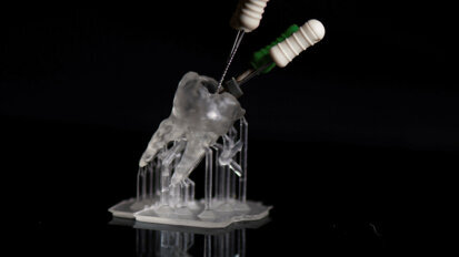 Unveiling the future: The thrilling evolution of dental 3D printing