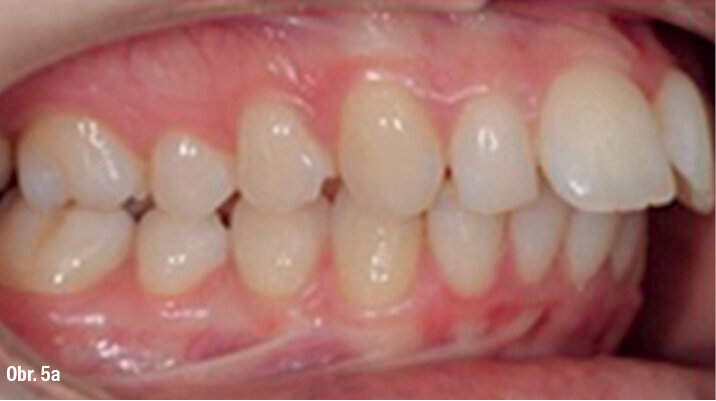 Kazuistika - popis v textu