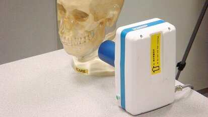 Cheap dental X-ray device puts users and patients at risk