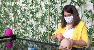 3 Boyutlu Yazıcı ile Kişiye Özel İmplant Üretiyorlar