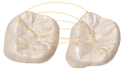 CEREC Biogeneric: now for crowns, veneers and anatomical bridges CEREC Biogeneric: now for crowns, veneers and anatomical bridges