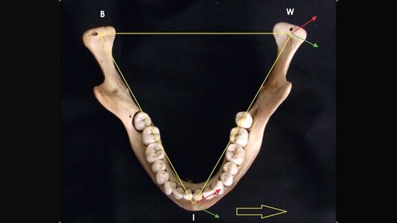 Kinesiographic analysis of lateral excursive movement on the horizontal plane: the retrusive component