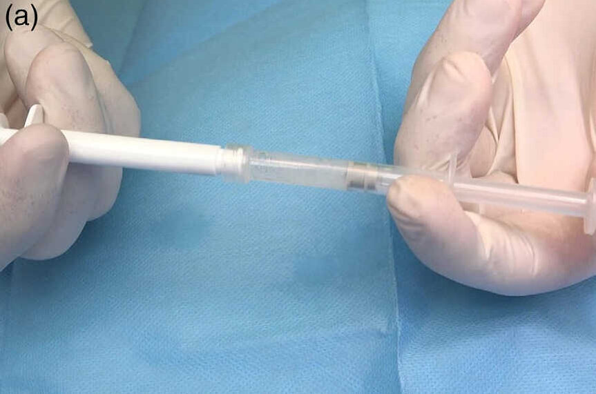 Fig. 1 (a) : Activation de la solution par mélange d’hypochlorite de sodium à 0,95 % avec des acides aminés, du chlorure de sodium, de l’oxyde de titane et de la carboxyméthylcellulose.
