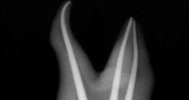 Dental Tribune Study Club develops clinicians’ skills via case studies database