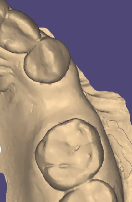 Fig. 4_La sella edentula.
