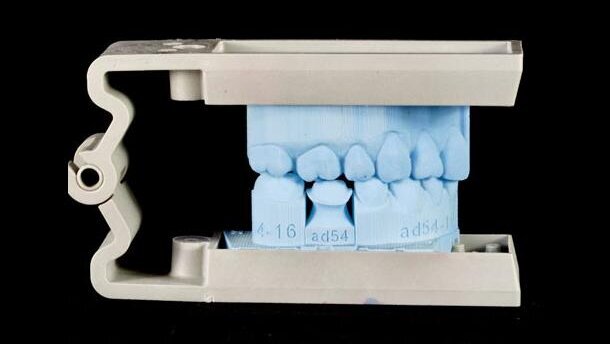 Modele 3D w stomatologii