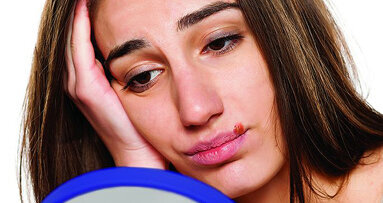 Forward Science licenses cold sore drug from EPI Health