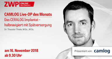 CAMLOG Live-OP am 16. November: Registrieren & CME-Punkt sichern