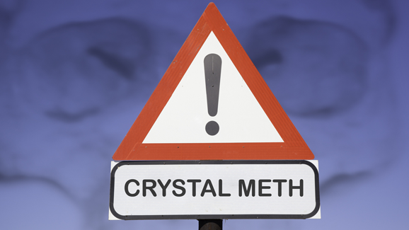 „Modedroge“ schädigt Zähne dauerhaft